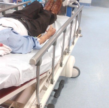 Internaţi la spital cu arsuri